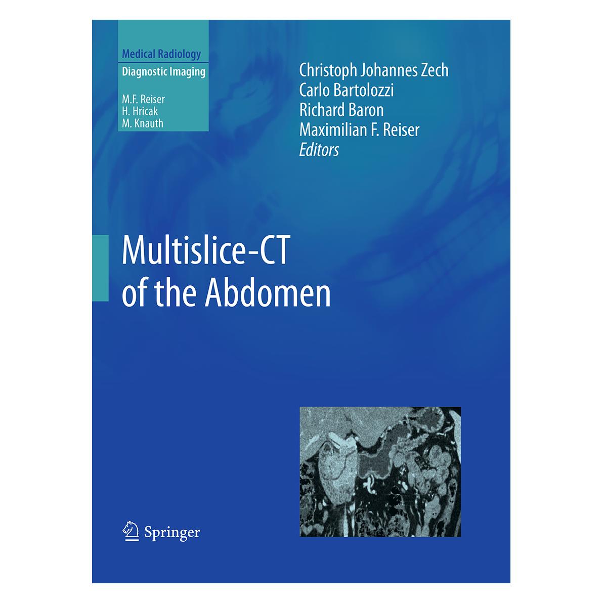 Springer Multislice-CT of the Abdomen (Englisch, Softcover, Carlo Bartolozzi, Christoph Johannes Zech, Maximilian F Reiser, Richard Baron) (55948138)