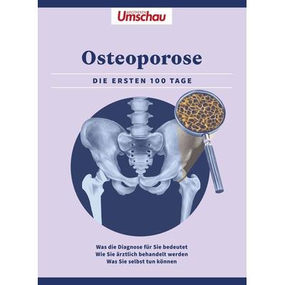 Apotheken Umschau: Osteoporose, Taschenbuch von , Wort & Bild, 978-3-927216-69-3