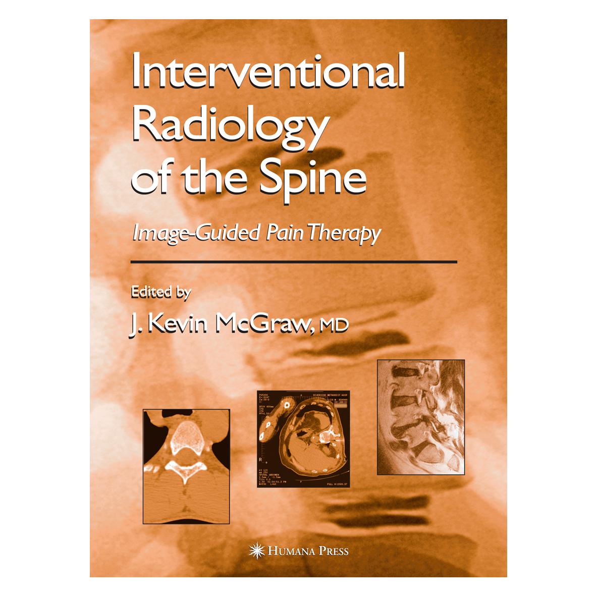 Springer Interventional Radiology of the Spine (Englisch, Softcover, J. Kevin McGraw) (55382889)