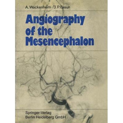 Angiography of the Mesencephalon, Taschenbuch von Auguste Wackenheim,Jean Paul Braun, Springer Berlin, 978-3-662-27882-6
