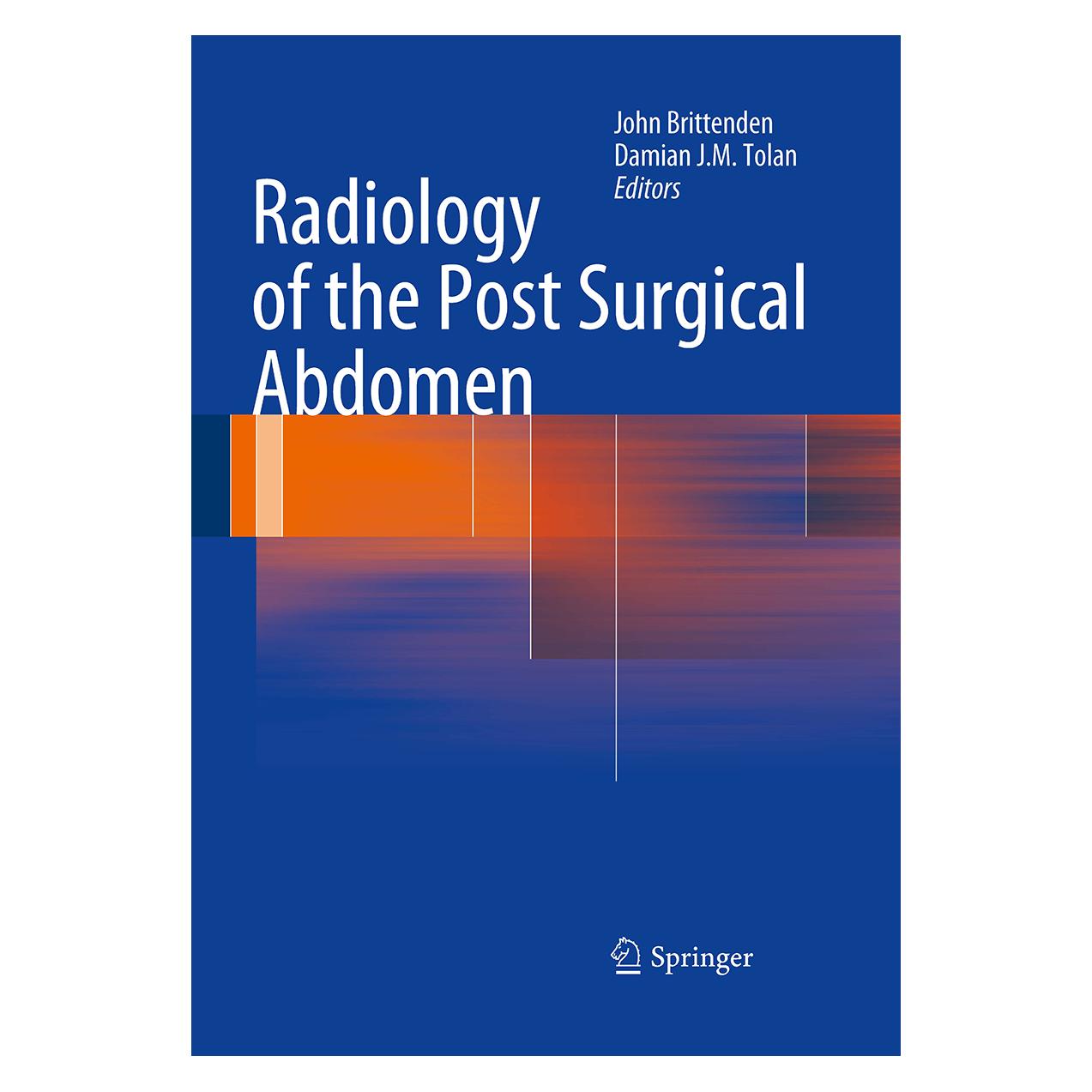 Springer Radiology of the Post Surgical Abdomen (Englisch, Softcover, Damian J.M. Tolan, John Brittenden) (55952672)