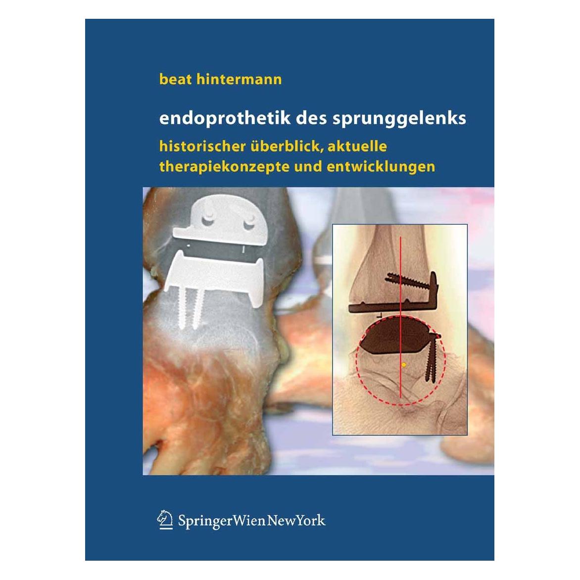 Springer Endoprothetik des Sprunggelenks (Deutsch, Hardcover, Beat Hintermann) (9783211235867)