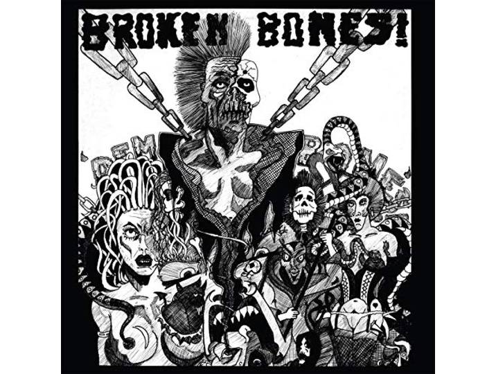 Broken Bones - Dem Bones