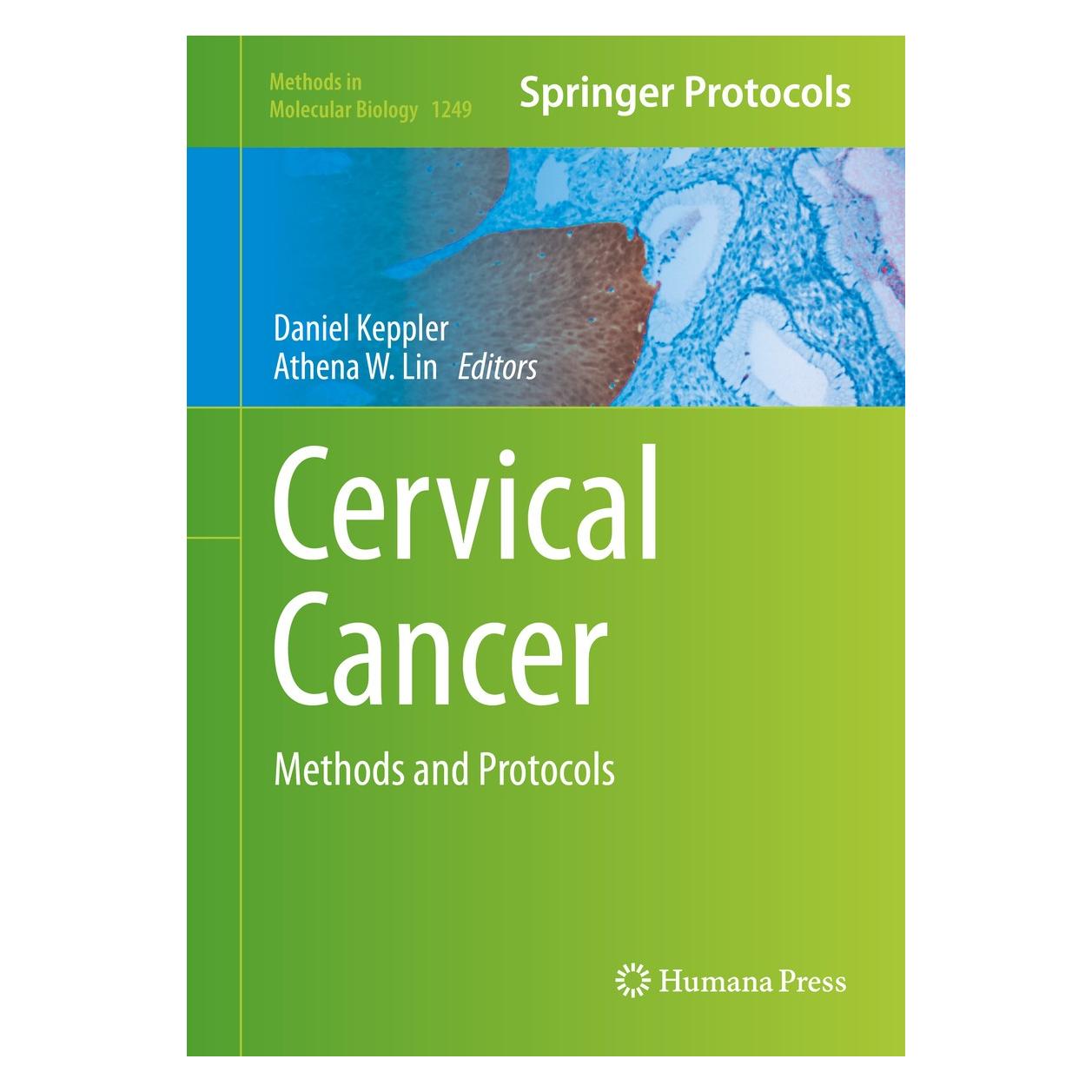 Springer Cervical Cancer (Englisch, Hardcover, Athena W. Lin, Daniel Keppler) (9781493920129)