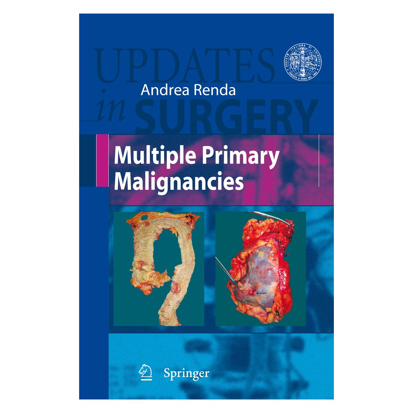 Springer Multiple Primary Malignancies (Englisch, Hardcover, Andrea Renda) (9788847010949)