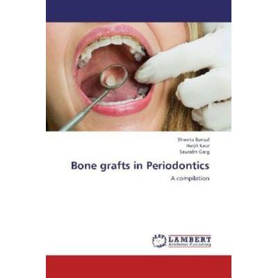 Bansal, S: Bone grafts in Periodontics, Taschenbuch von Shweta Bansal,Harjit Kaur,Saurabh Garg, LAP LAMBERT Academic Publishing, 978-3-659-20489-0