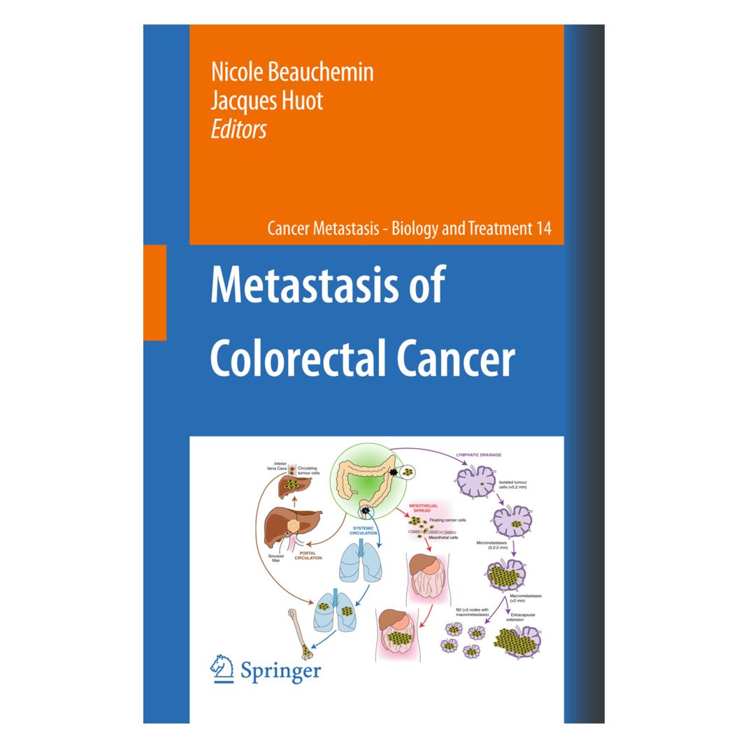 Springer Metastasis of Colorectal Cancer (Englisch, Softcover, Jacques Huot, Nicole Beauchemin) (55498756)