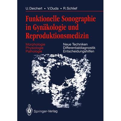Funktionelle Sonographie in Gynäkologie und Reproduktionsmedizin, Taschenbuch von Ulrich Deichert,Volker Duda,Reinhard Schlief, Springer Berlin,
