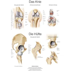 Lehrtafel Das Knie / Die Hüfte  50x70cm