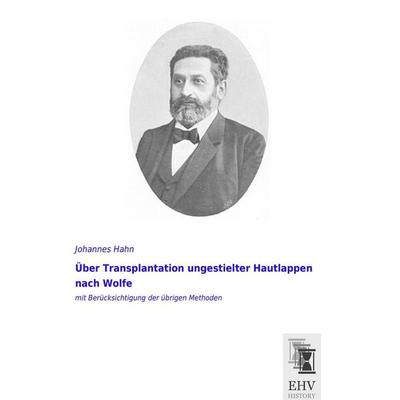 Über Transplantation ungestielter Hautlappen nach Wolfe, Taschenbuch von Johannes Hahn, EHV-History, 978-3-95564-716-2