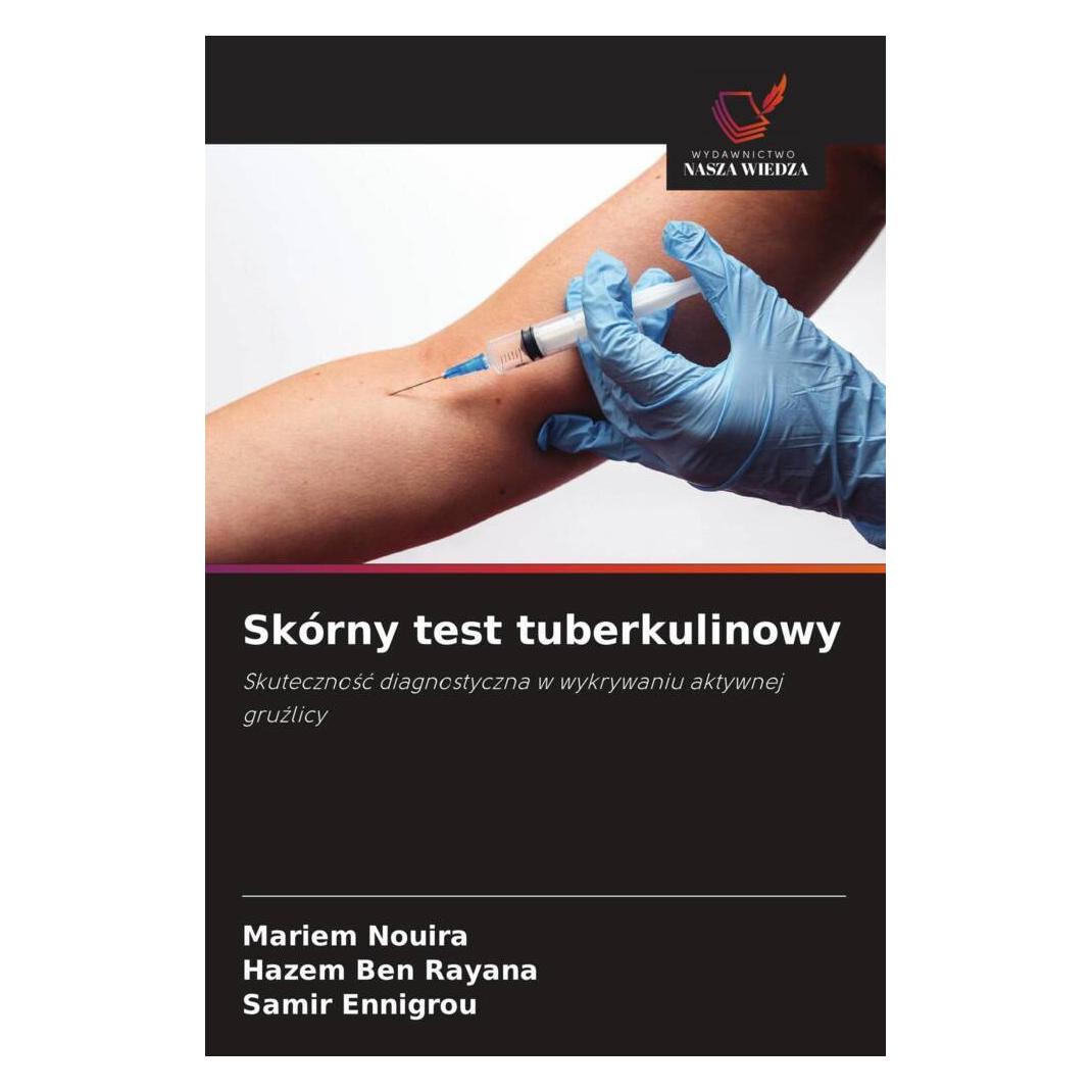 Wiedza Powszechna Skórny test tuberkulinowy (Softcover, Hazem Ben Rayana, Mariem Nouira, Samir Ennigrou) (57169863)
