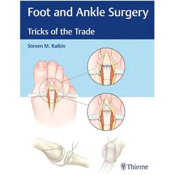Foot and Ankle Surgery, Fachbücher von Steven M. Raikin, Steven Raikin