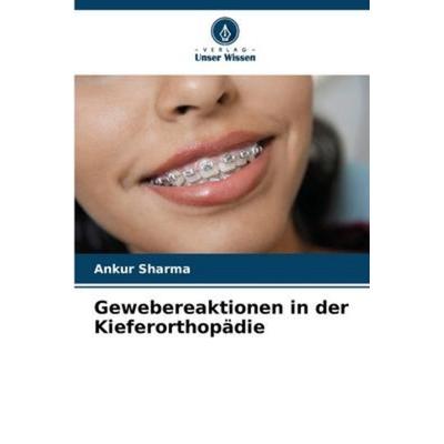 Gewebereaktionen in der Kieferorthopädie, Taschenbuch von Ankur Sharma, Verlag Unser Wissen, 978-620-5-38188-5