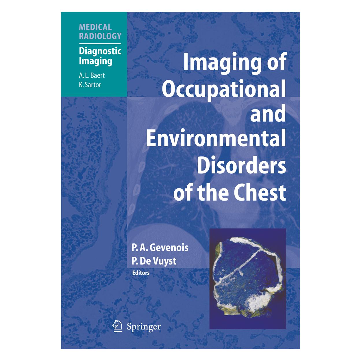 Springer Imaging of Occupational and Environmental Disorders of the Chest (Englisch, Softcover, Paul de Vuyst, Pierre Alain Gevenois) (55948363)