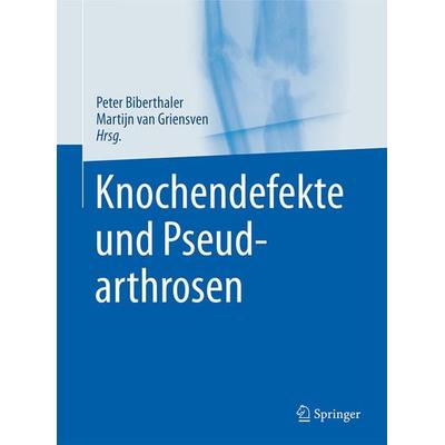 Knochendefekte und Pseudarthrosen, Gebundene Ausgabe von Peter Biberthaler,Martijn van Griensven,Patrick Delhey, Springer Berlin, 978-3-642-44990-1