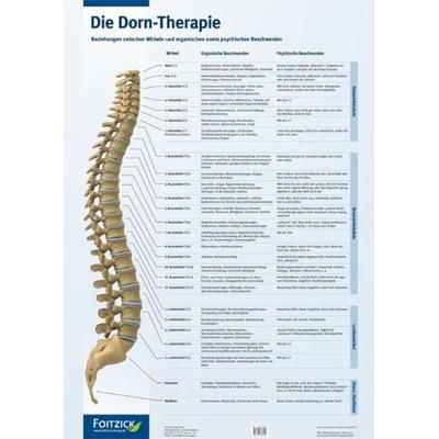Die Dorn-Therapie, Poster, Sonstige von Helmuth Koch, Mgo fachverlage, 978-3-929338-58-4
