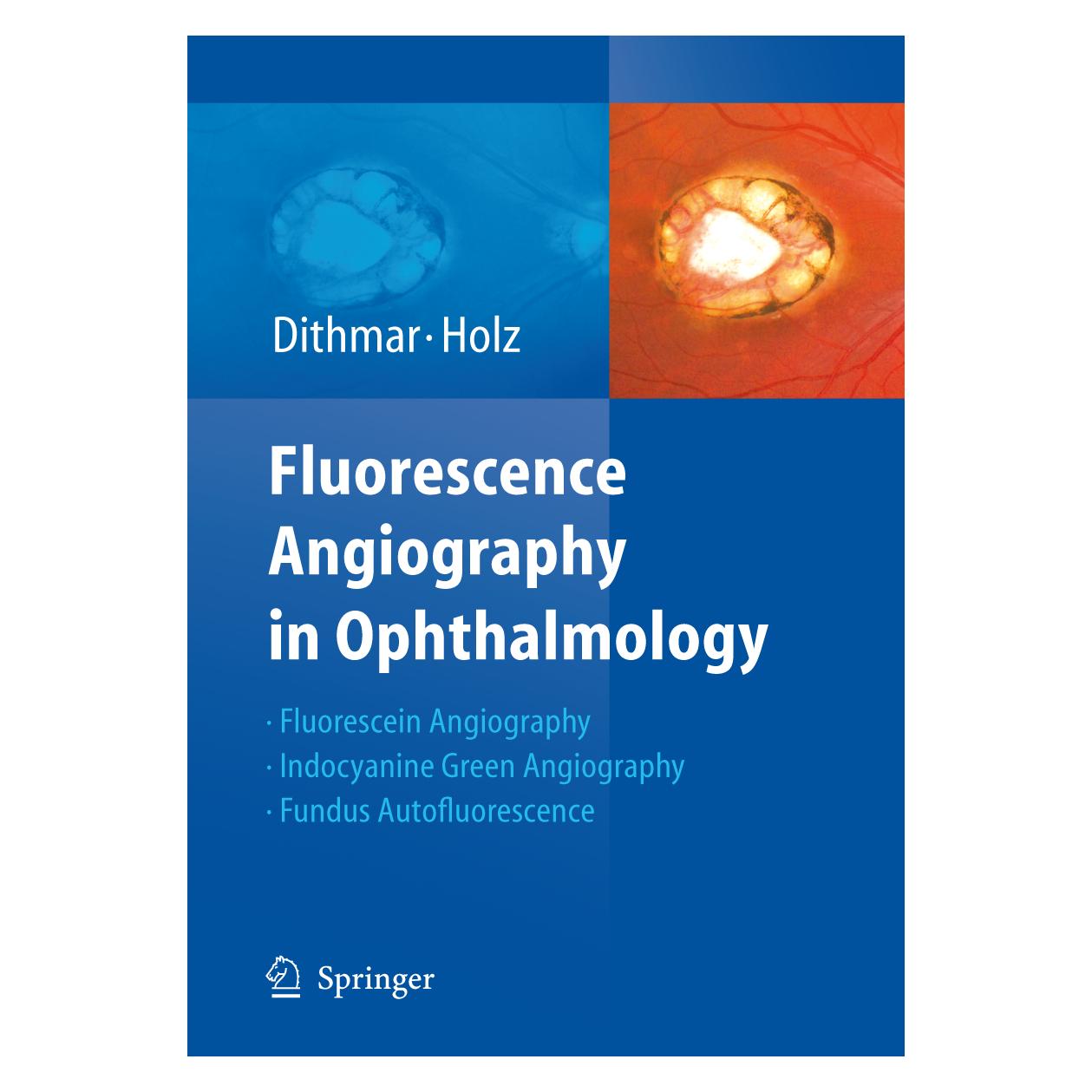 Springer Fluorescence Angiography in Ophthalmology (Englisch, Softcover, Frank G Holz, Stefan Dithmar) (55947102)