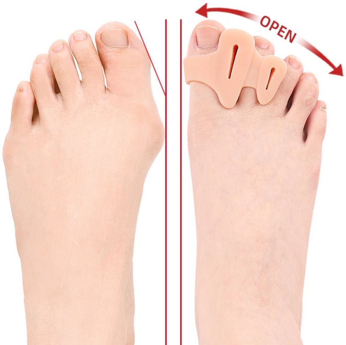 INF SEBS-Zehentrenner mit Doppelöffnung zur Hallux-Korrektur und bei überlappenden Zehen, waschbar, wiederverwendbar, im Schuh Haut