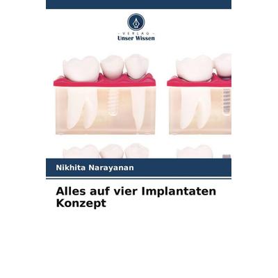Alles auf vier Implantaten Konzept, Taschenbuch von Nikhita Narayanan, Verlag Unser Wissen, 978-620-4-82479-6