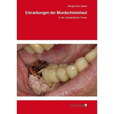Erkrankungen der Mundschleimhaut, Taschenbuch von Margrit-Ann Geibel, Lehmanns Media, 978-3-86541-611-7