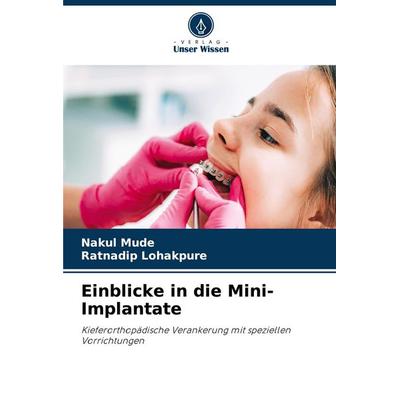 Einblicke in die Mini-Implantate, Taschenbuch von Nakul Mude,Ratnadip Lohakpure, Verlag Unser Wissen, 978-620-8-78016-6