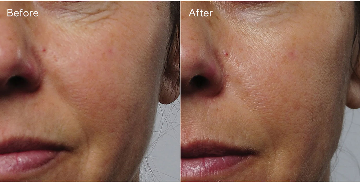 MURAD Rapid Collagen Infusion 30ml