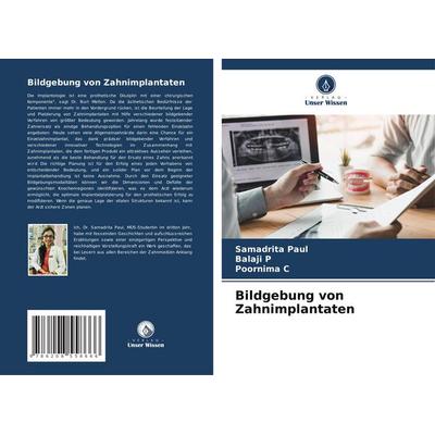 Bildgebung von Zahnimplantaten, Taschenbuch von Samadrita Paul,Balaji P.,Poornima C., Verlag Unser Wissen, 978-620-8-55866-6
