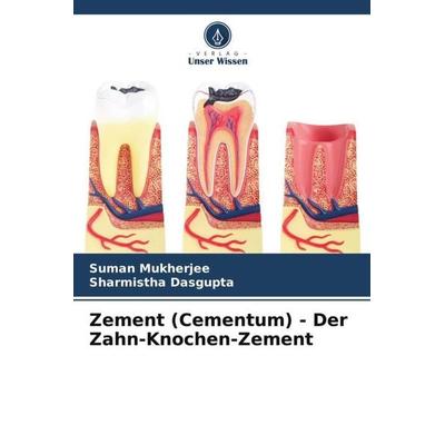 Zement (Cementum) - Der Zahn-Knochen-Zement, Taschenbuch von Suman Mukherjee,Sharmistha Dasgupta, Verlag Unser Wissen, 978-620-5-46401-4