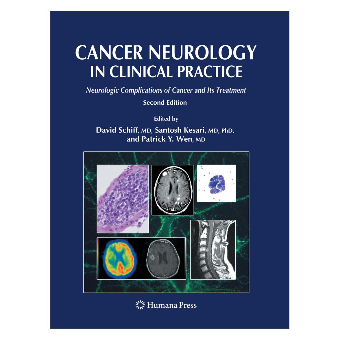 Springer Cancer Neurology in Clinical Practice (Englisch, Softcover, David Schiff, Patrick C. Y. Wen, Santosh Kesari) (55574983)