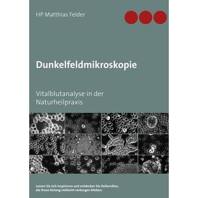 Dunkelfeldmikroskopie, Taschenbuch von Matthias Felder, BoD – Books on Demand, 978-3-7460-9953-8