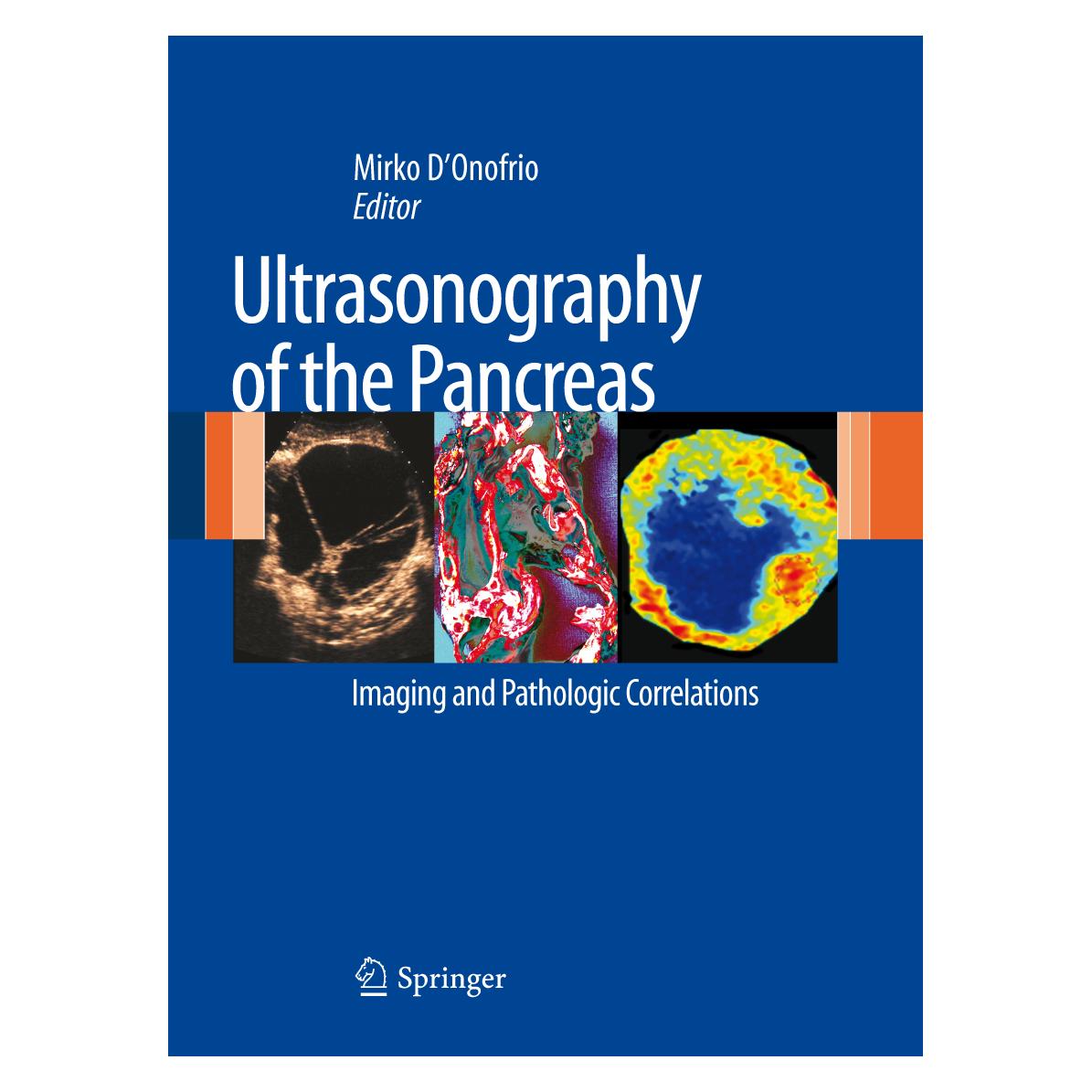 Springer Ultrasonography of the Pancreas (Englisch, Hardcover, Mirko D'Onofrio) (9788847023789)