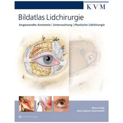 Bildatlas Lidchirurgie, Fachbücher von Alina Zubcov-Iwantscheff, Alina Fratila
