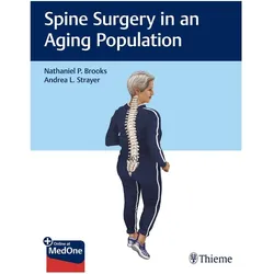 Brooks:Spine Surgery in an Aging Popula, Sachbücher