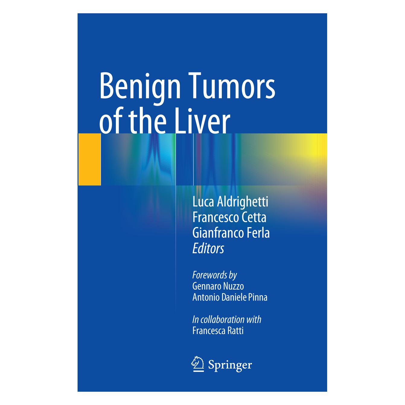 Springer Benign Tumors of the Liver (Englisch, Softcover, Francesco Cetta, Gianfranco Ferla, Luca Aldrighetti) (55850077)