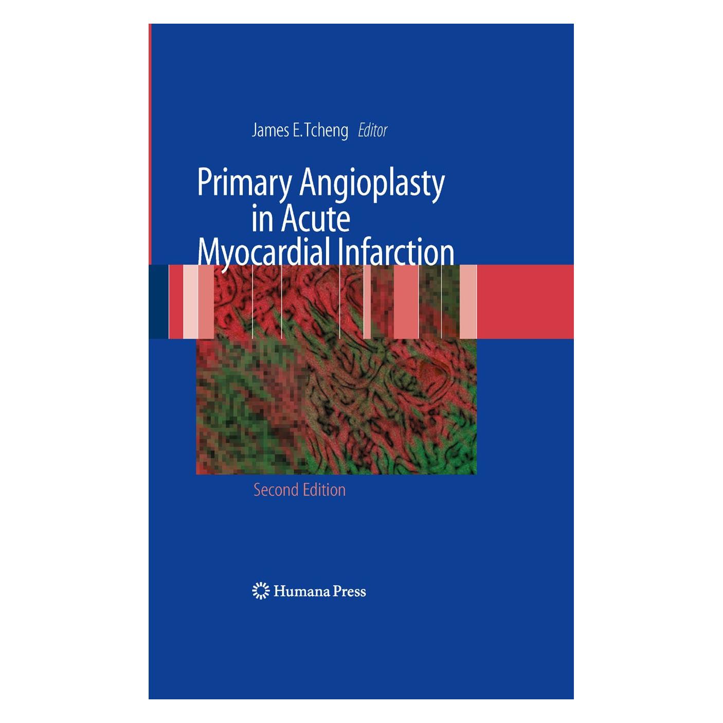 Humana Press Primary Angioplasty in Acute Myocardial Infarction (Englisch, Hardcover, James E. Tcheng) (9781603274968)