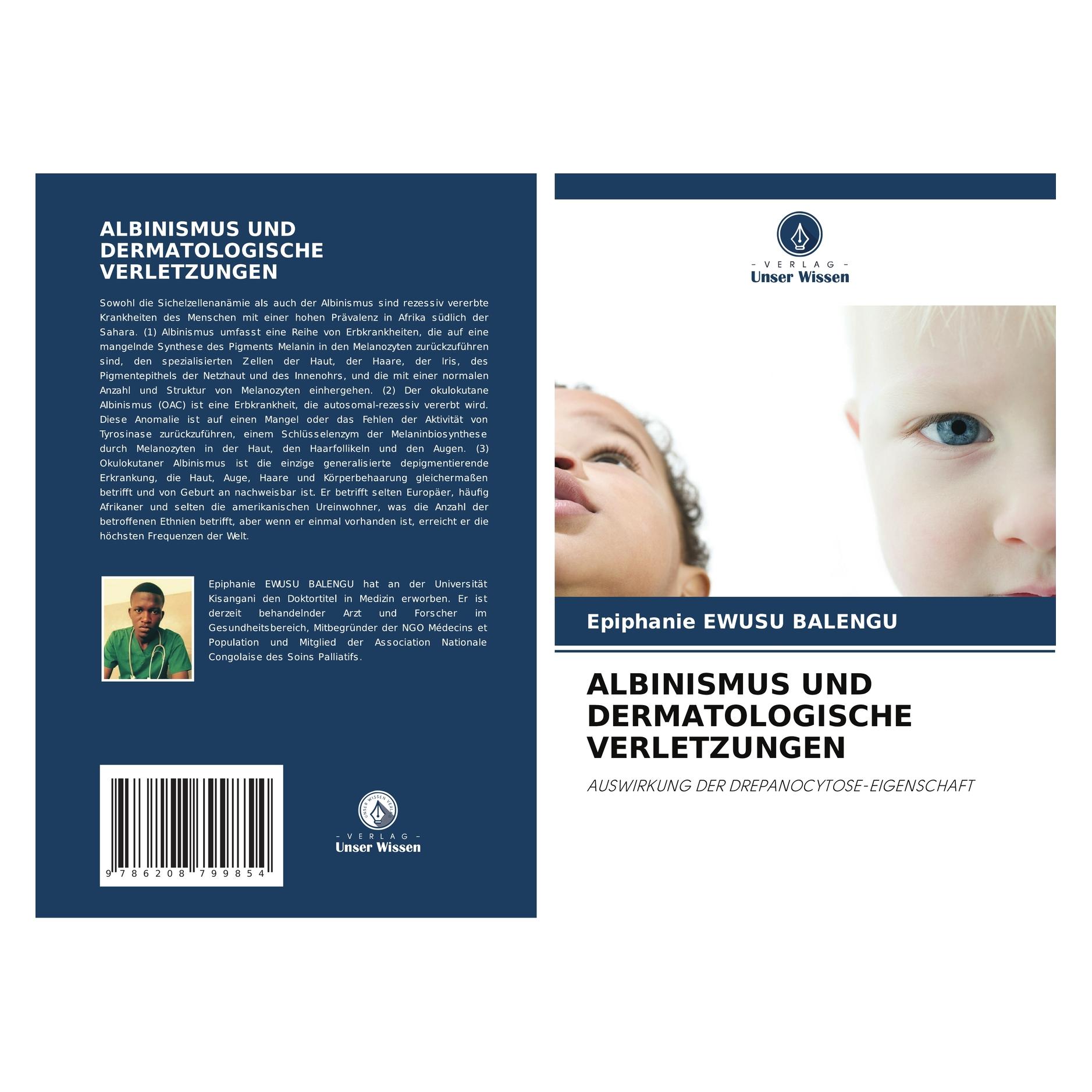 Bod Albinismus Und Dermatologische Verletzungen (Deutsch, Softcover, Epiphanie EWUSU BALENGU) (63625708)