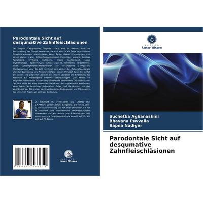 Parodontale Sicht auf desqumative Zahnfleischläsionen, Taschenbuch von Suchetha Aghanashini,Bhavana Puvvalla,Sapna Nadiger, Verlag Unser Wissen,