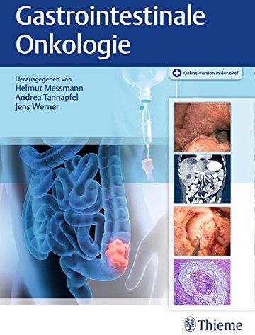 Helmut Messmann - Gastrointestinale Onkologie - Preis vom 09.10.2026 07:28:09 h