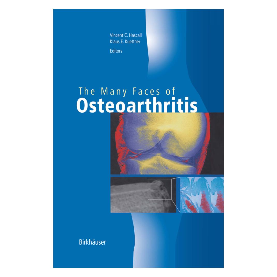 Birkhäuser The Many Faces of Osteoarthritis (Englisch, Softcover, Klaus E. Kuettner, Vincent C. Hascall) (55526352)