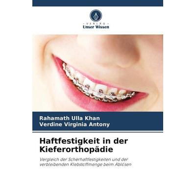 Haftfestigkeit in der Kieferorthopädie, Taschenbuch von Rahamath Ulla Khan,Verdine Virginia Antony, Verlag Unser Wissen