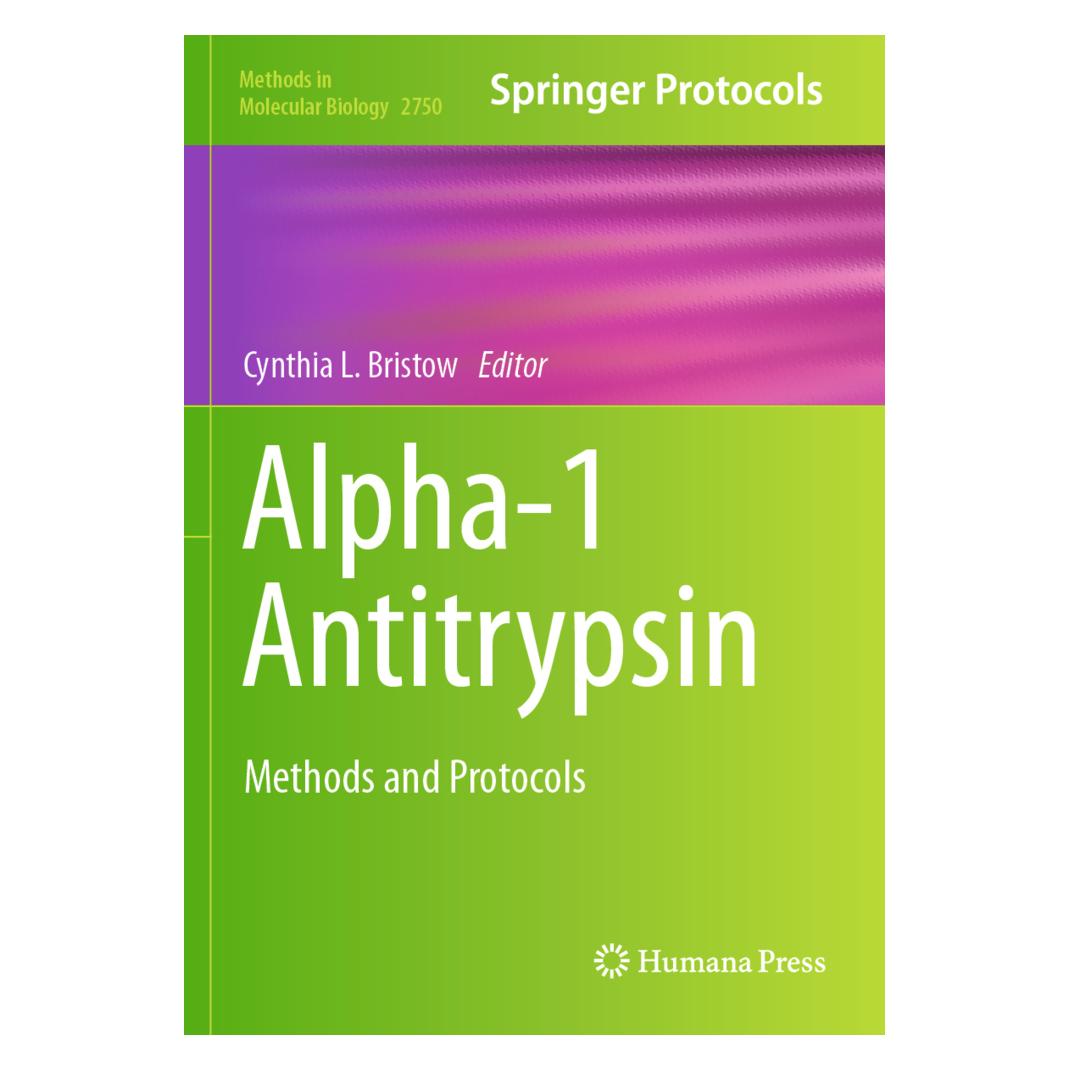 Springer Alpha-1 Antitrypsin (Englisch, Softcover) (57181069)