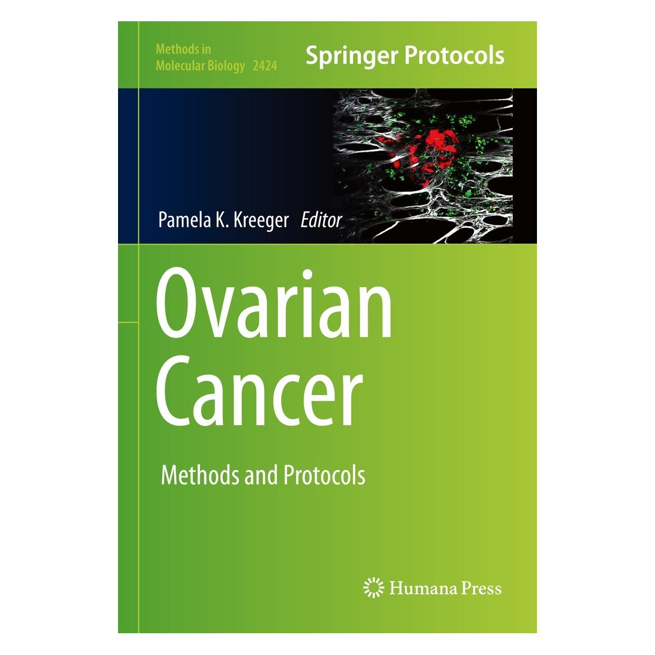 Springer Ovarian Cancer (Englisch, Hardcover, Pamela K. Kreeger) (9781071619551)