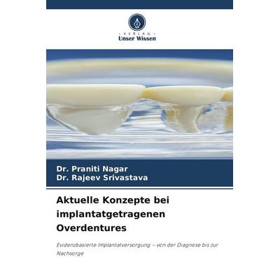 Aktuelle Konzepte bei implantatgetragenen Overdentures, Taschenbuch von Praniti Nagar,Rajeev Srivastava, Verlag Unser Wissen