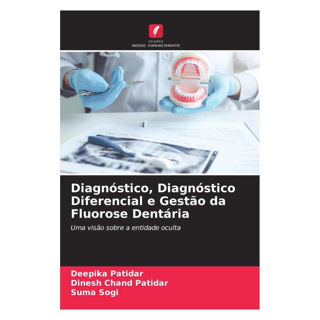 Edicoes Nosso Conhecimento Diagnóstico, Diagnóstico Diferencial e Gestão da Fluorose Dentária (Softcover, Deepika Patidar, Dinesh Chand Patidar, Suma Sogi) (56234103)