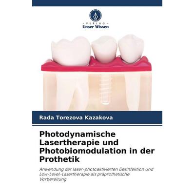 Photodynamische Lasertherapie und Photobiomodulation in der Prothetik, Taschenbuch von Rada Torezova Kazakova, Verlag Unser Wissen, 978-620-4-16392-5