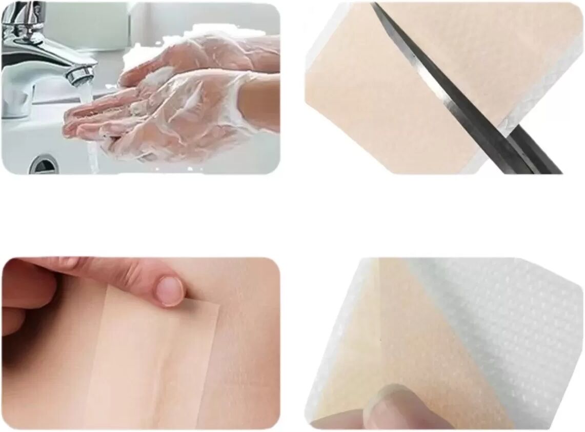 INF Bandes de silicone pour cicatrices - 2 rouleaux de ruban couleur peau pour traitement des cicatrices M