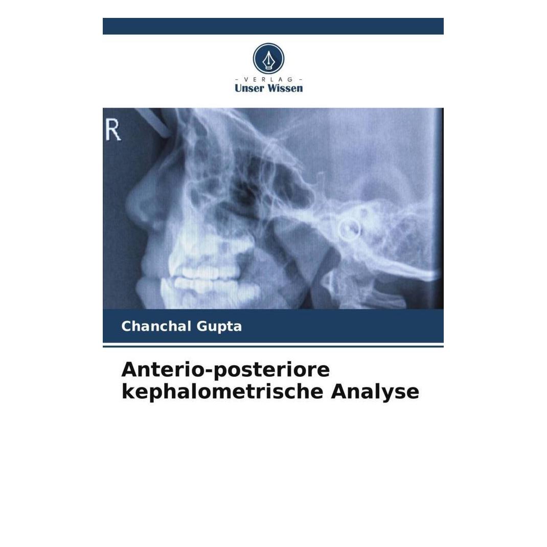 Unser Wissen Anterio-posteriore kephalometrische Analyse (51572772)