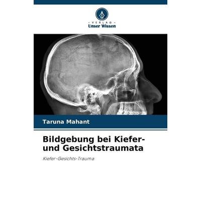 Bildgebung bei Kiefer- und Gesichtstraumata, Taschenbuch von Taruna Mahant, Verlag Unser Wissen, 978-620-9-26409-2