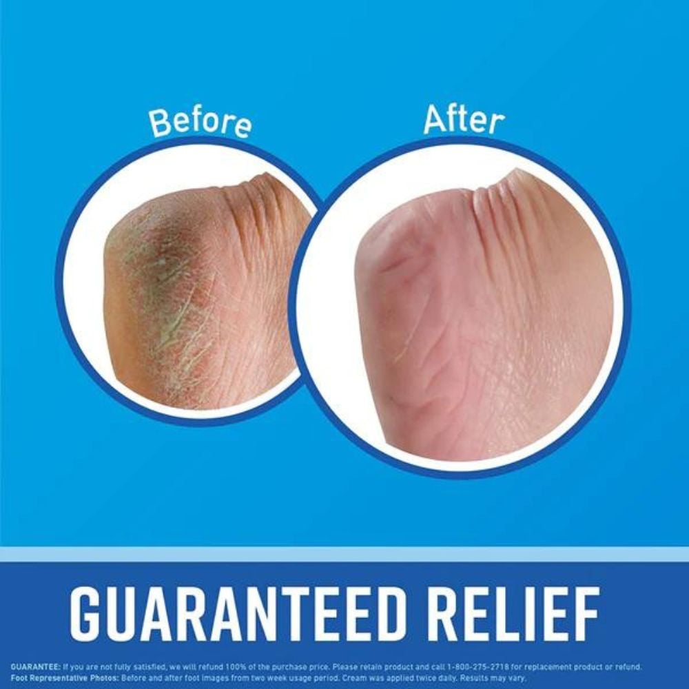 O'Keeffe's Healthy Feet Cream for Extremely Dry, Cracked Feet 80mL