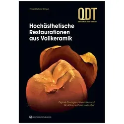Hochästhetische Restaurationen aus Voll, Fachbücher von Vincent Fehmer